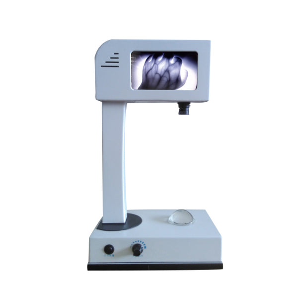 LCD imaging Vein Finder Viewer Registered in CE, Vein Locator Detector, Transilluminator Visualization Lights for Nurses, Imaging of Subcutaneous Veins Spider Veins, Facial Veins for IV Phlebotomy - eLynn Medical