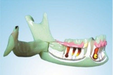 Dental Mandibular Tissue Teeth Demonstration Model Patient Education NEW - eLynn Medical