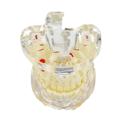 Dental Mixed Dentition Upper Lower JAW ANATOMY TEETH MODEL 5-9 Yr Teenager NEW - eLynn Medical