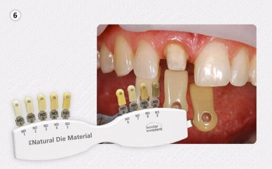 IPS Natural Die Material Shade Guide - Ivoclar Vivadent - eLynn Medical