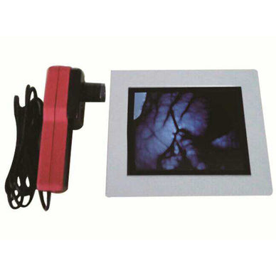 LCD imaging Vein Finder Viewer Registered in CE, Vein Locator Detector, Transilluminator Visualization Lights for Nurses - eLynn Medical